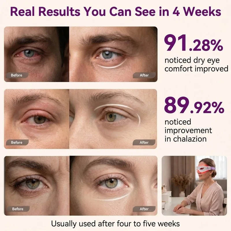 4 Wavelength LED Eye Phototherapy Mask | Under-Eye Skin Rejuvenation - Image 6